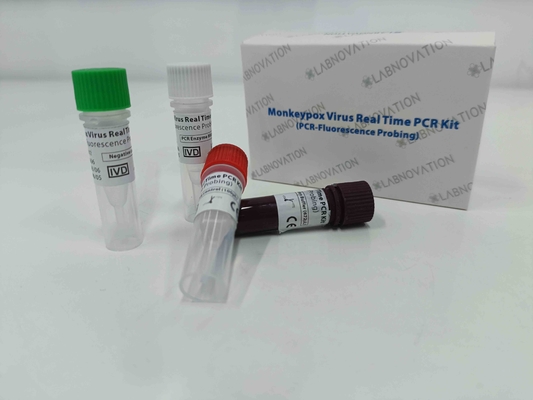 Échantillons rapides d'exsudat de lésion de sérum de Kit Real Time For Human d'essai d'ACP de virus de Monkeypox